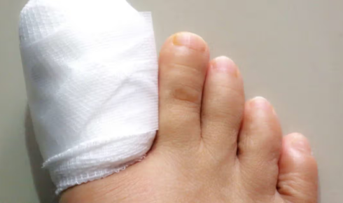 experienced ingrown toenail doctor